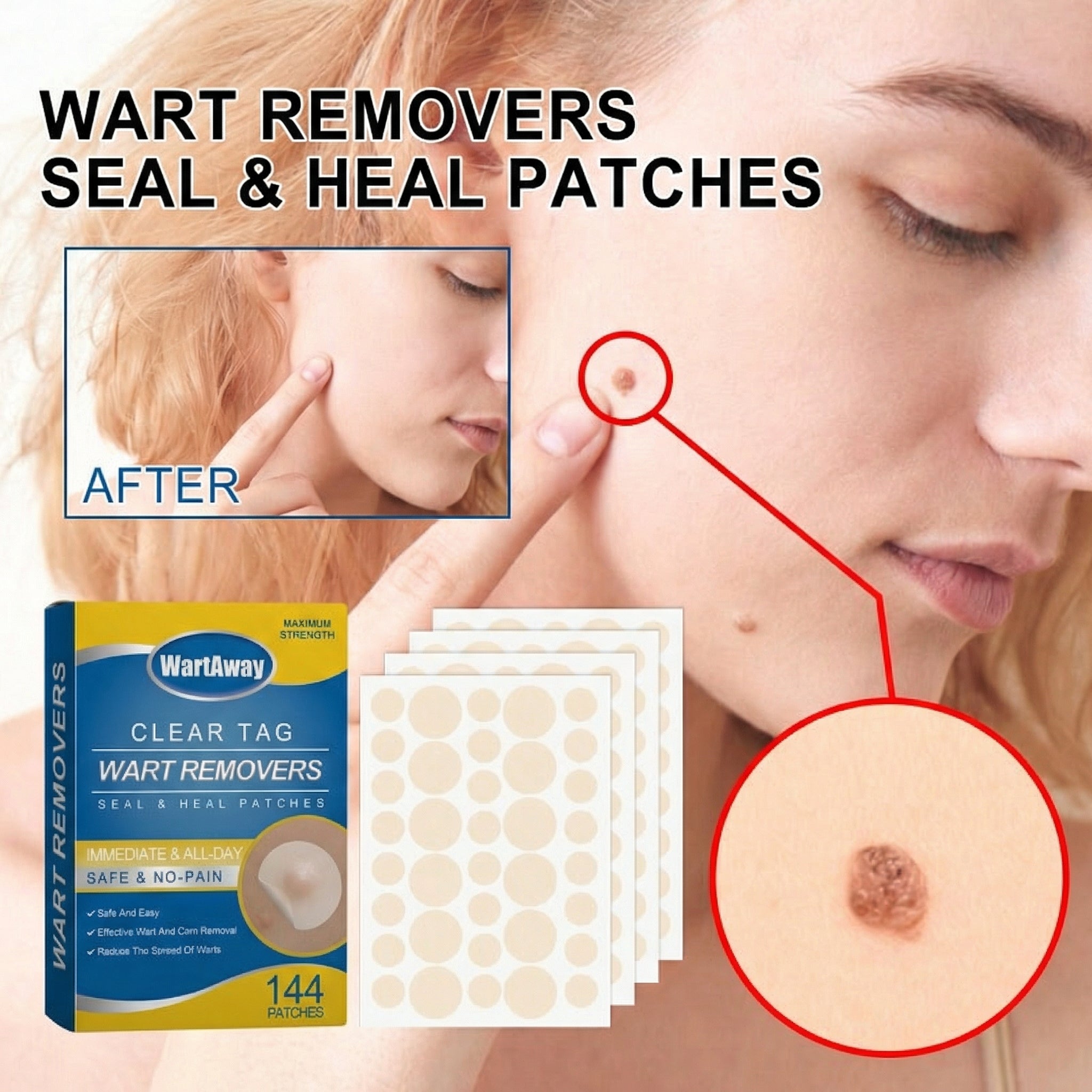 WartAway™ Wart Removal Patches
